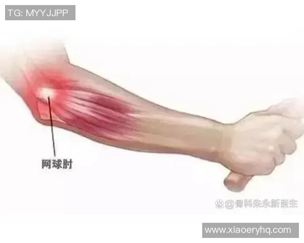上海网球队整体压制力解析：如何在网球赛场上占据优势地位